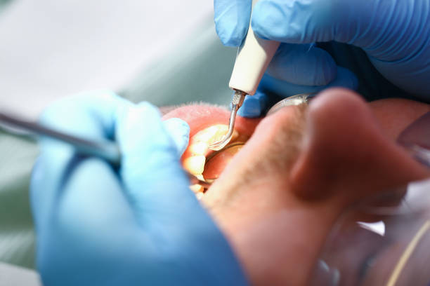 Best Weekend Emergency Dentist in Del City, OK