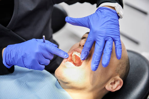 Best Emergency Tooth Extraction in Del City, OK