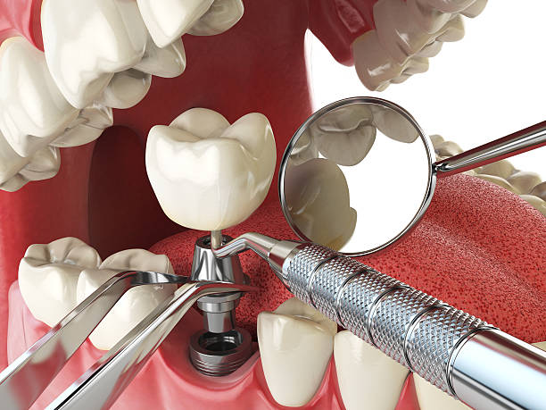 Best Emergency Denture Repair in Del City, OK